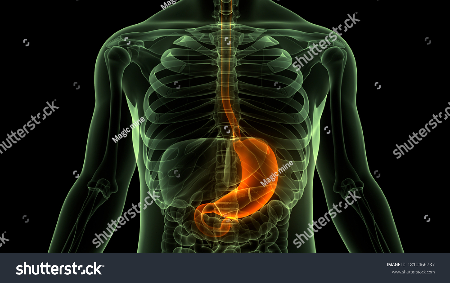 str.kepvalto_9_cim_Gyomorszulites